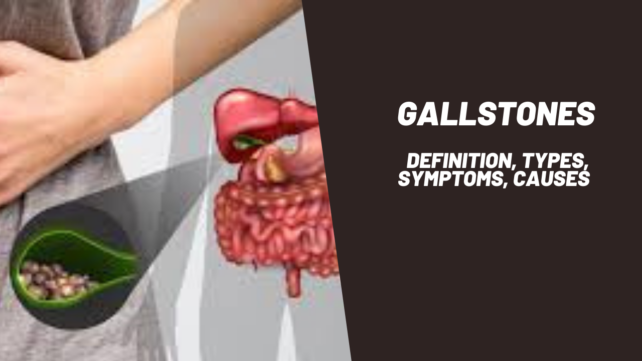 Gallstones Definition, Types, Symptoms, Causes Grocare® India