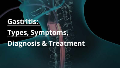 Gastritis: Types, Symptoms, Diagnosis, Treatment