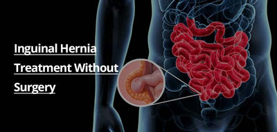 Inguinal Hernia Treatment Without Surgery