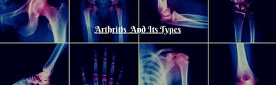 Arthritis: Types, Causes, Symptoms, Medications, And Treatment