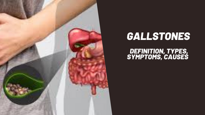 Gallstones: Definition, Types, Symptoms, Causes