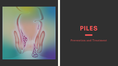 Everything You Need To Know About Piles — Prevention and Treatment
